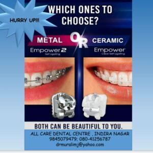 Best dentist in Bangalore