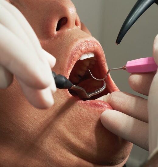 best dental clinic in Bangalore