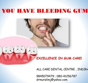 Best dental clinic in Bangalore