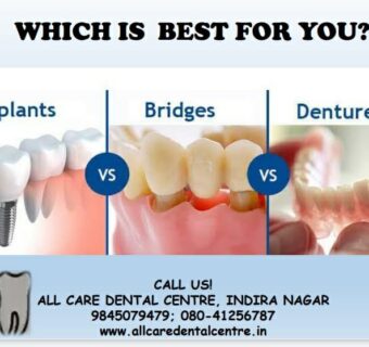 Best dental clinic in Bangalore