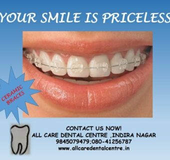 Best dental clinic in Bangalore