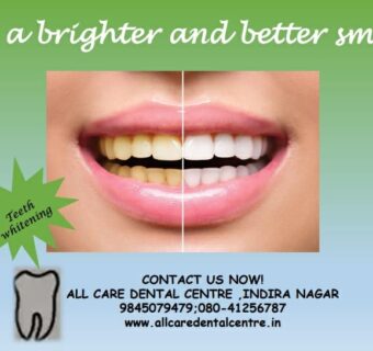 smile makeovers in bangalore