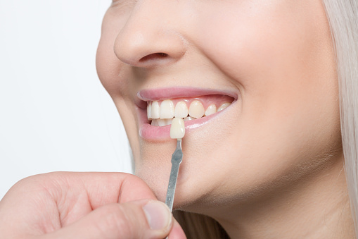 Best dental clinic in Bangalore